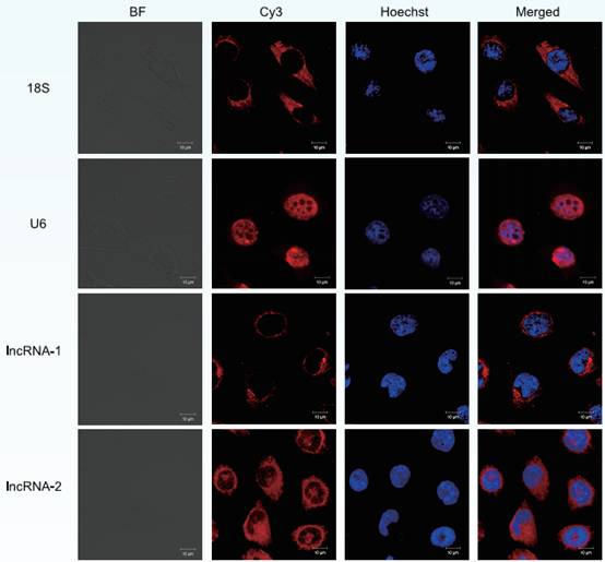 lncRNA FISH检测试剂盒