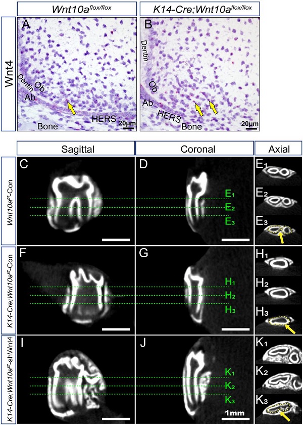 wnt4的补偿性上调促进了k14-cre;wnt10aflox/flox小鼠的牙髓增殖和牛