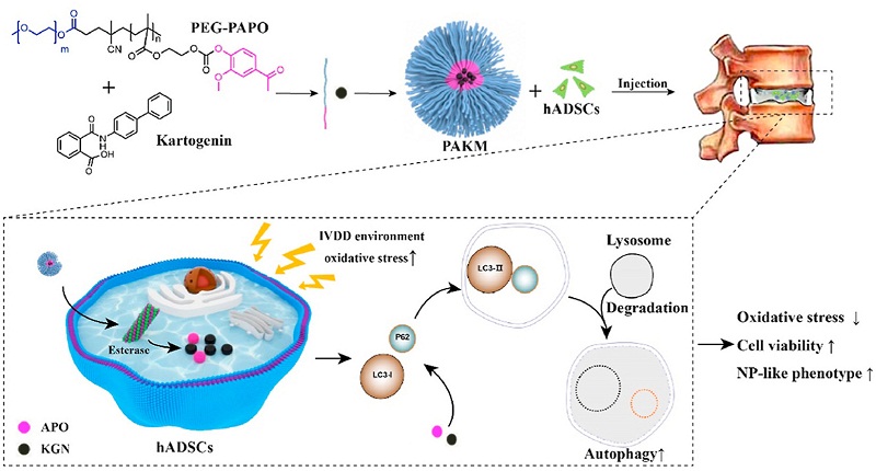 浙大团队开发出新型聚合物胶束,有望治疗椎间盘退变