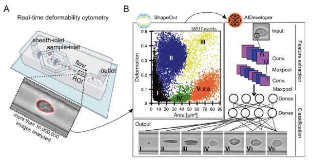 Elevated deformability of immune cells in people with depression