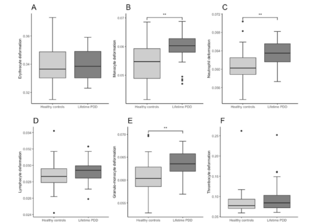 Elevated deformability of immune cells in people with depression