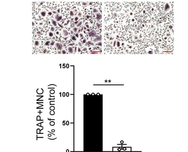 New breakthrough in the treatment of rheumatoid arthritis