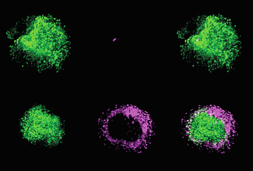 Research image comparing neurons that lack the ZFP462 gene to wildtype neurons.