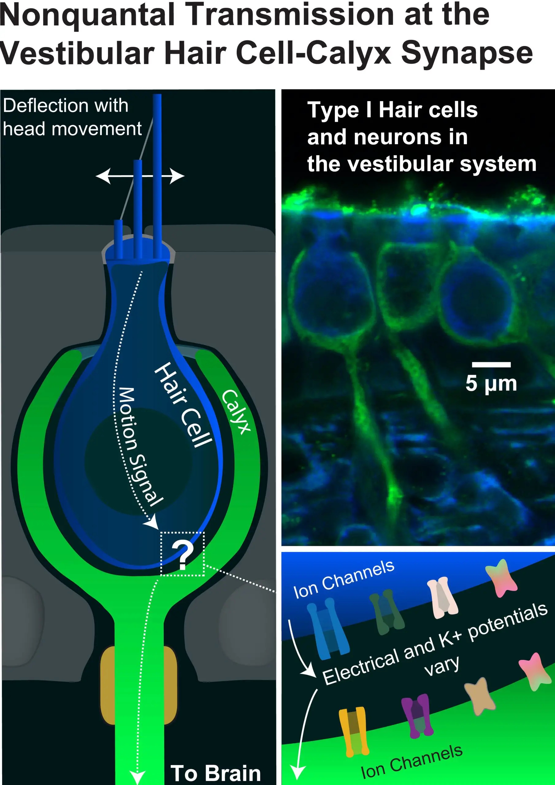 Vestibular-Hair-Cell-Calyx-Illustration-and-Microscopic-Image-scaled.webp.jpg