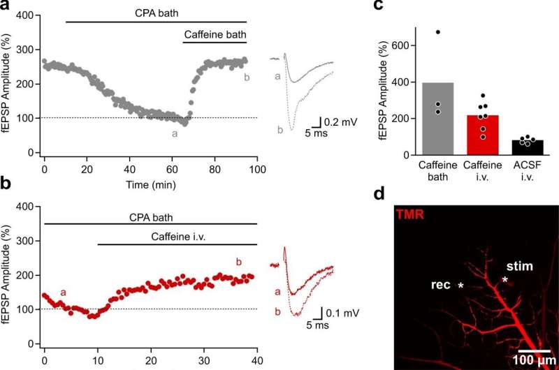 Tracking down leaks in the blood-brain barrier