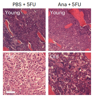 How to rejuvenate the hematopoietic system without blood transfusion?