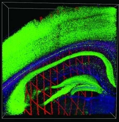 For the first time, researchers record long-term electrical activity in a single brain cell