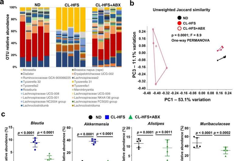 New research establishes how and why diets high in sugar and fat cause liver disease