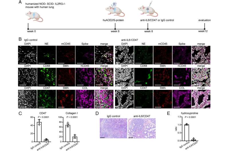 Runaway immune reactions cause long COVID breathing problems