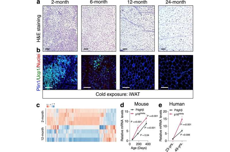 'Beige fat' could hold key to age-related metabolism change