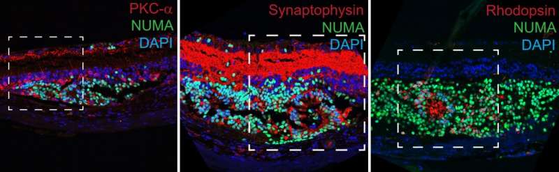Scientists achieve promising results towards restoring vision in blindness caused by cellular degeneration in the eye