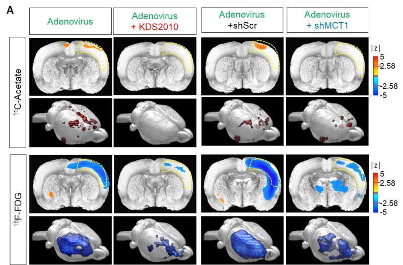 A new breakthrough in Alzheimer disease research - visualizing reactive astrocyte-neuron interaction