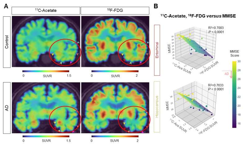 A new breakthrough in Alzheimer disease research - visualizing reactive astrocyte-neuron interaction