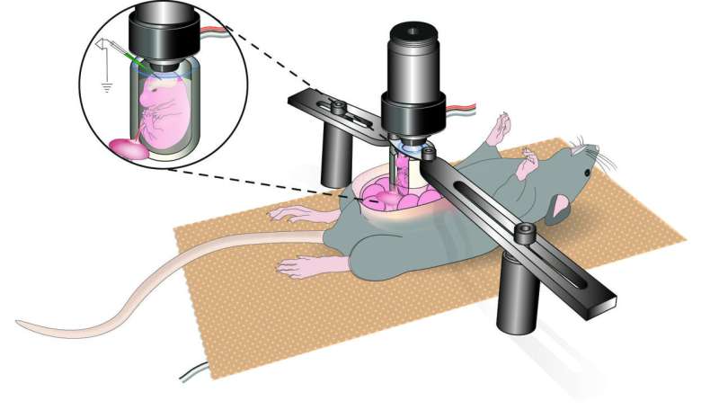 Researchers discover a new embryonic brain circuit