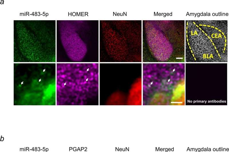 Gene in the brain can put brakes on anxiety, discover scientists