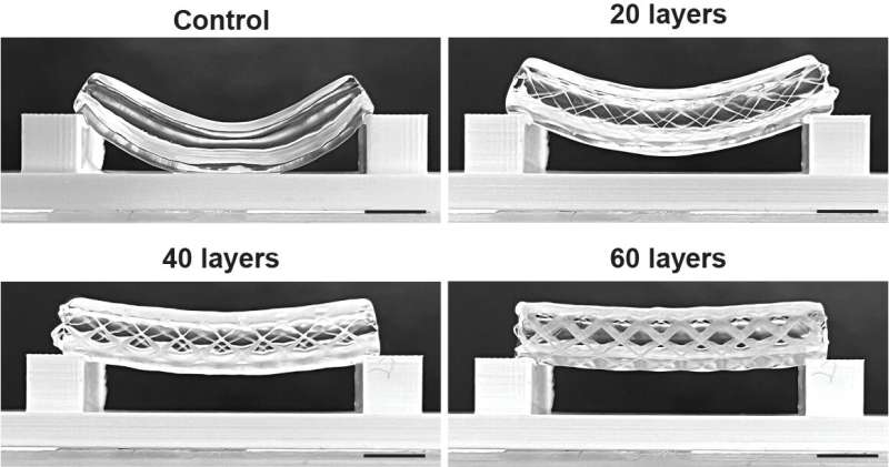 Combining bioprinting techniques to pursue functional blood vessels