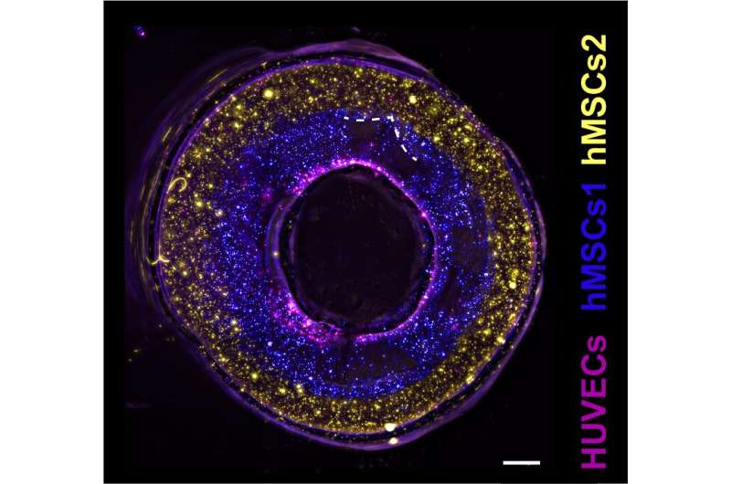 Combining bioprinting techniques to pursue functional blood vessels